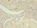 EBP Antibody in Immunohistochemistry (Paraffin) (IHC (P))