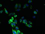 DARC Antibody in Immunocytochemistry (ICC/IF)