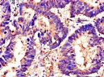 SWI5 Antibody in Immunohistochemistry (Paraffin) (IHC (P))