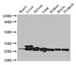 SWI5 Antibody in Western Blot (WB)