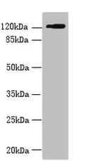 SLC4A8 Antibody in Western Blot (WB)