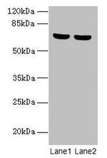 SYTL3 Antibody in Western Blot (WB)