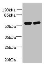 TCTE1 Antibody in Western Blot (WB)