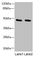 IGSF11 Antibody in Western Blot (WB)