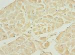 TNNI3K Antibody in Immunohistochemistry (Paraffin) (IHC (P))