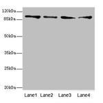 TNNI3K Antibody in Western Blot (WB)