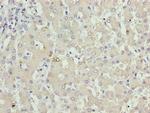 KHDC1 Antibody in Immunohistochemistry (Paraffin) (IHC (P))