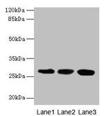 KHDC1 Antibody in Western Blot (WB)