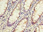 ACSM3 Antibody in Immunohistochemistry (Paraffin) (IHC (P))