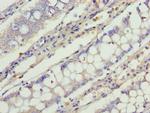 C1orf101 Antibody in Immunohistochemistry (Paraffin) (IHC (P))