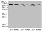 C1orf101 Antibody in Western Blot (WB)