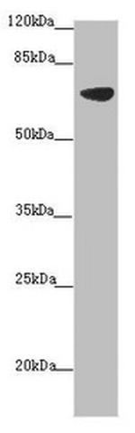 SLC34A1 Antibody in Western Blot (WB)