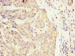 SLC22A25 Antibody in Immunohistochemistry (Paraffin) (IHC (P))