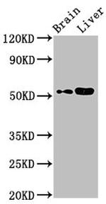 CHST9 Antibody in Western Blot (WB)