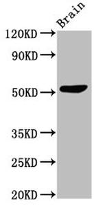 SLC30A10 Antibody in Western Blot (WB)