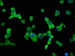 SCN10A Antibody in Immunocytochemistry (ICC/IF)