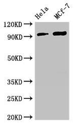 TTC27 Antibody in Western Blot (WB)