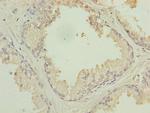 PTPLB Antibody in Immunohistochemistry (Paraffin) (IHC (P))