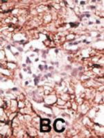 LSD1 Antibody in Immunohistochemistry (Paraffin) (IHC (P))