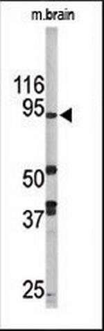 LSD1 Antibody in Western Blot (WB)