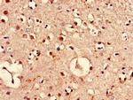 PIM3 Antibody in Immunohistochemistry (Paraffin) (IHC (P))