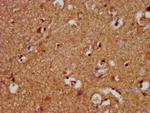 NALP10 Antibody in Immunohistochemistry (Paraffin) (IHC (P))