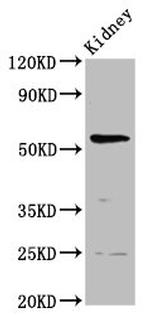 PIGW Antibody in Western Blot (WB)