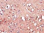 LRRTM4 Antibody in Immunohistochemistry (Paraffin) (IHC (P))