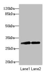 RNF36 Antibody in Western Blot (WB)