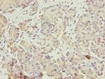 ERO1LB Antibody in Immunohistochemistry (Paraffin) (IHC (P))