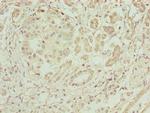 ERO1LB Antibody in Immunohistochemistry (Paraffin) (IHC (P))