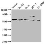 SLC37A2 Antibody in Western Blot (WB)