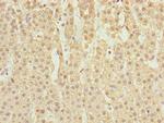 NORE1 Antibody in Immunohistochemistry (Paraffin) (IHC (P))