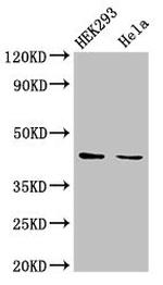 LPGAT1 Antibody in Western Blot (WB)