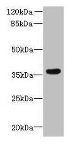 ZDHHC12 Antibody in Western Blot (WB)