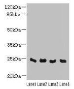 C4orf33 Antibody in Western Blot (WB)