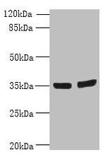 OSR2 Antibody in Western Blot (WB)