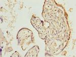 LIX1 Antibody in Immunohistochemistry (Paraffin) (IHC (P))