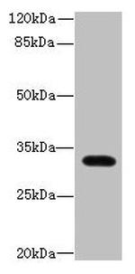 LIX1 Antibody in Western Blot (WB)