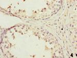 KBTBD7 Antibody in Immunohistochemistry (Paraffin) (IHC (P))