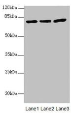 KBTBD7 Antibody in Western Blot (WB)