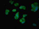 PDCL2 Antibody in Immunocytochemistry (ICC/IF)