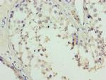 L3MBTL4 Antibody in Immunohistochemistry (Paraffin) (IHC (P))