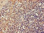 C22orf13 Antibody in Immunohistochemistry (Paraffin) (IHC (P))