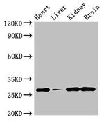 C22orf13 Antibody in Western Blot (WB)