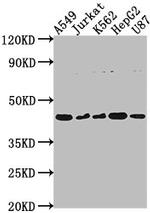 DNASE2B Antibody in Western Blot (WB)