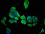 ACY3 Antibody in Immunocytochemistry (ICC/IF)