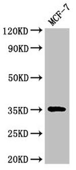 ACY3 Antibody in Western Blot (WB)