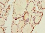 THRSP Antibody in Immunohistochemistry (Paraffin) (IHC (P))