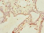 THRSP Antibody in Immunohistochemistry (Paraffin) (IHC (P))